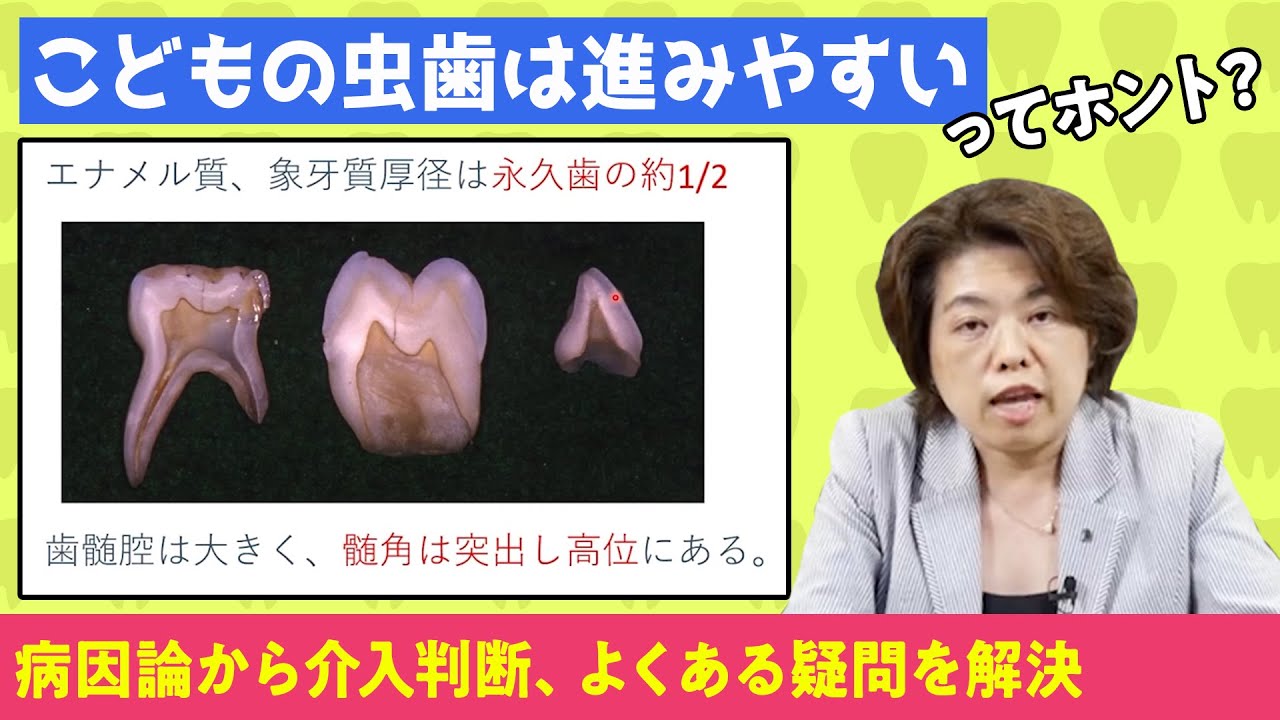 Deciduous Tooth Caries] Learn in-depth about cariology in