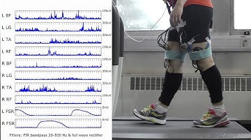 Experimental set-up & EMG and foot contact recording