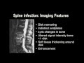 Understanding Basic MRI of the Spine