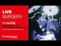 Live surgery - Dr. Roberto Castricini