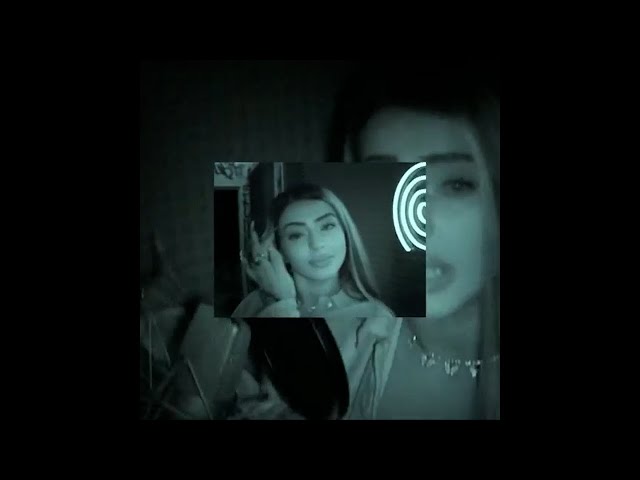 ALIZADE - ANORMAL ( Slowed * Reverb )