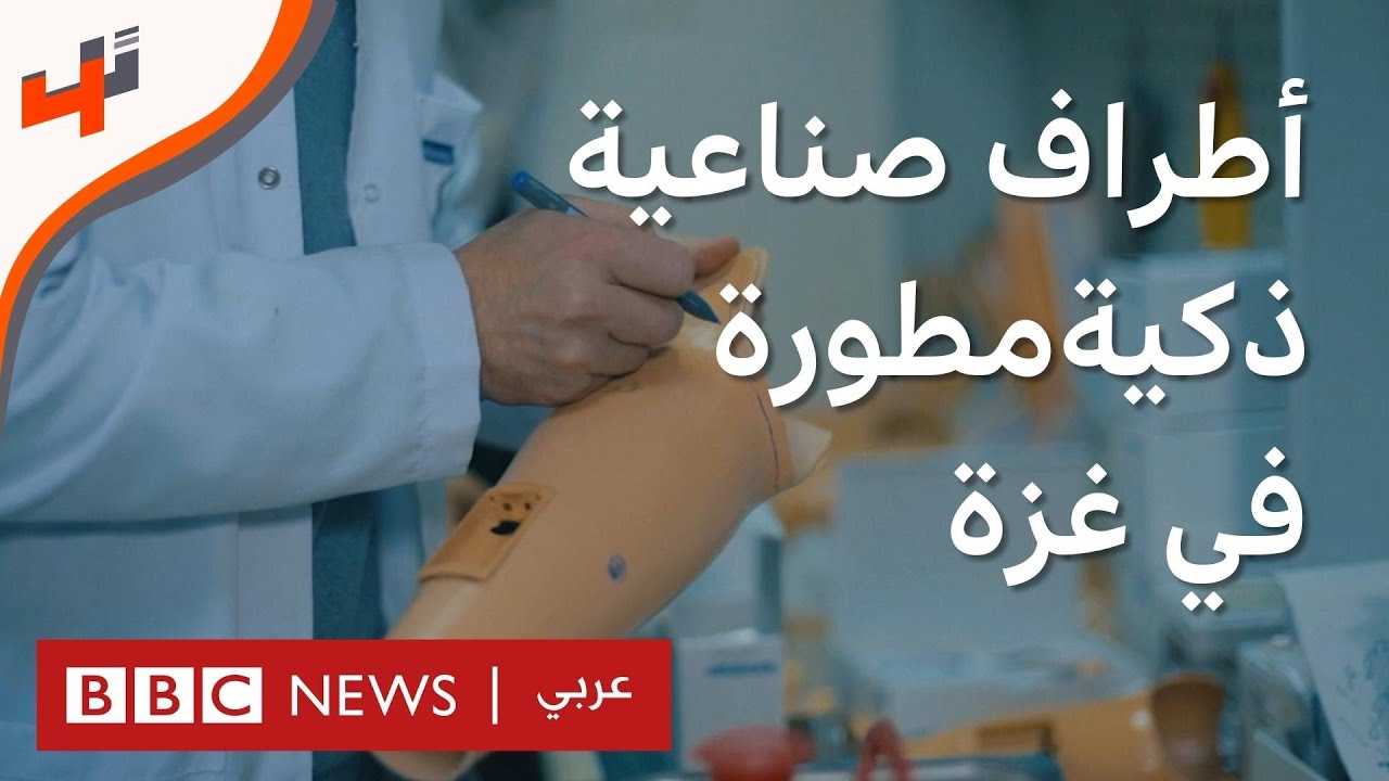 تقنيات جديدة لتطوير أطراف صناعية ذكية