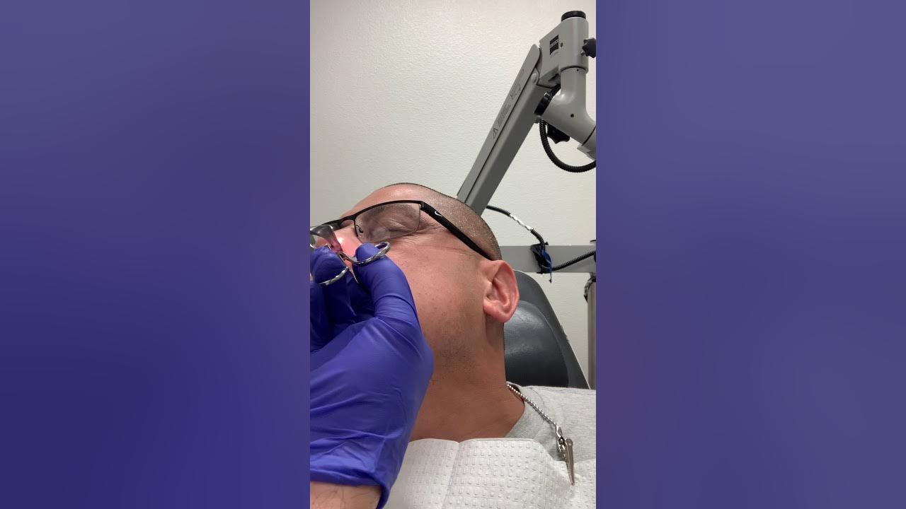 Septoplasty splint removal YouTube