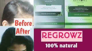 Regrowz - Hair Regrowth Treatment - Review in Tamil