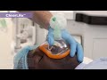 ClearLite™ anaesthetic face masks - a clear vision for the future. Dutch Social Media