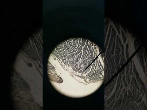 Purkinje fibers histology