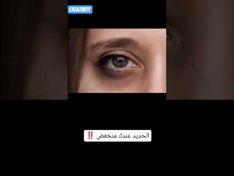 مادة الحديد عندك منخفضة شوفي الفيديو واقرائي الكابشن