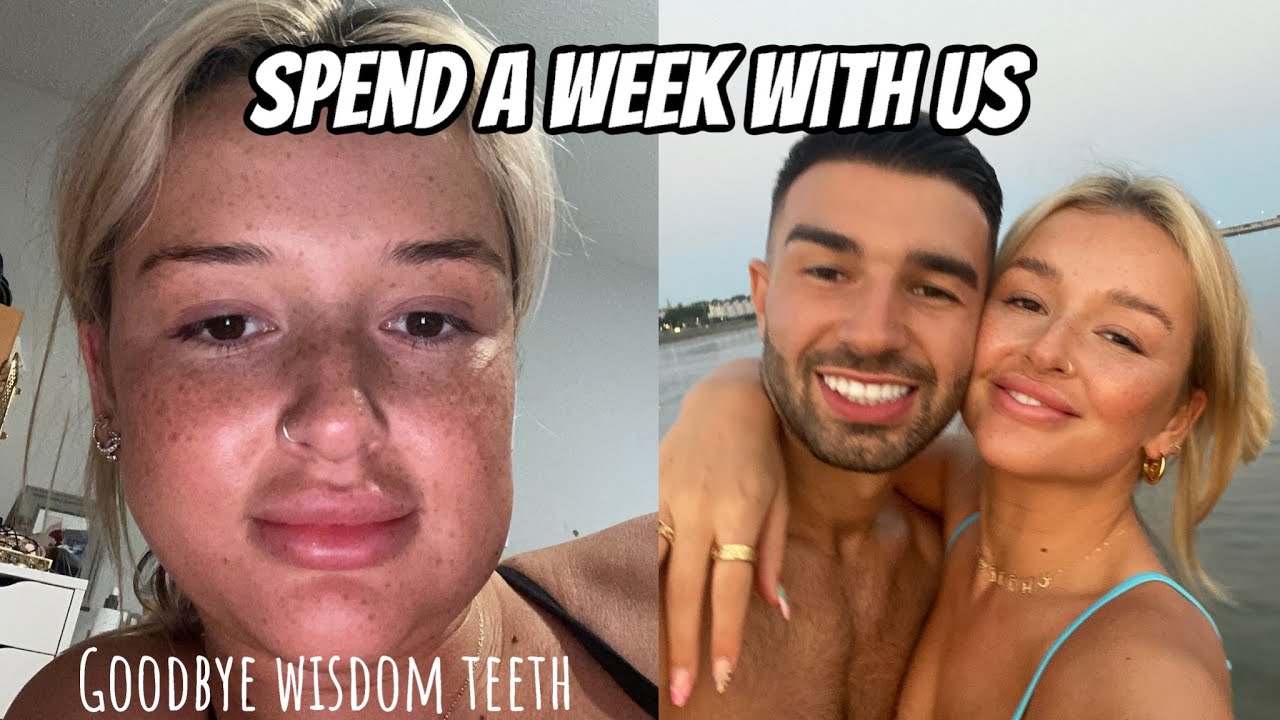 GETTING MY WISDOM TEETH OUT | A WEEK WITH US VLOG | CHARLEEN MURPHY
