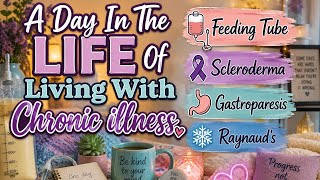 A Day In The Life Of A Chronically Ill Patient * Scleroderma * Gastroparesis * Raynauds * Crochet