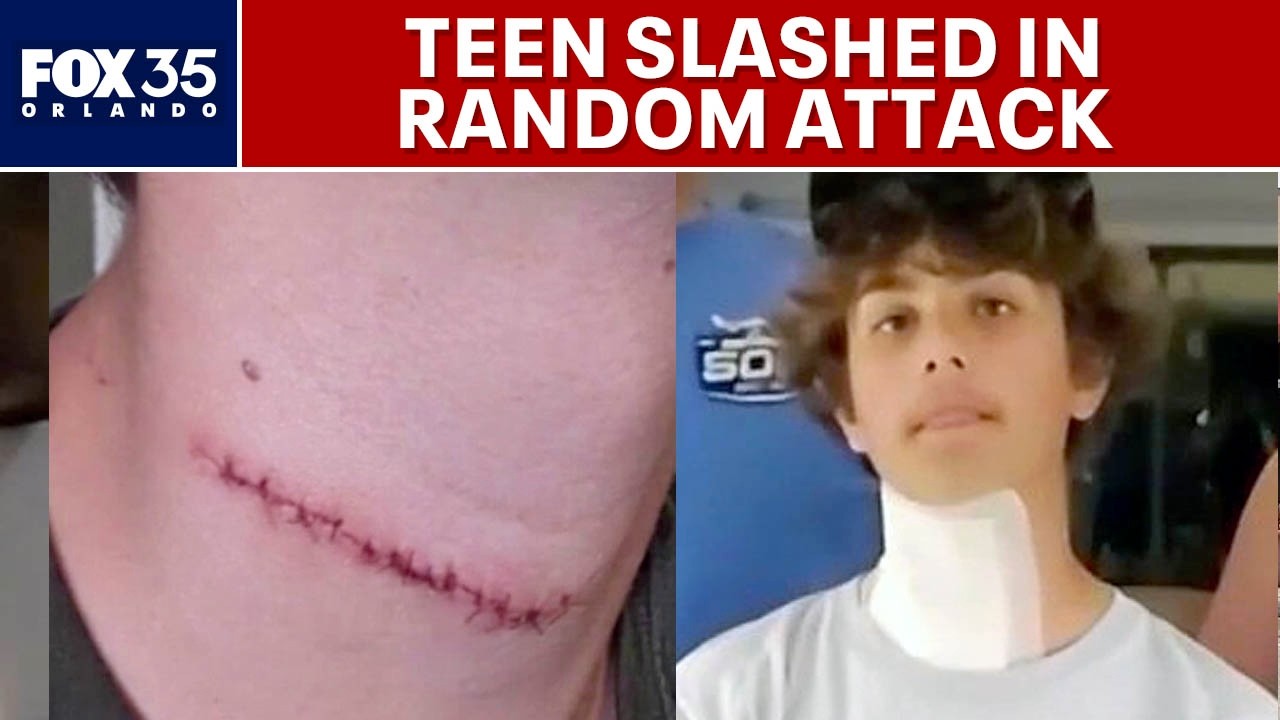 Teen’s throat slashed in random attack near Daytona Beach Pier
