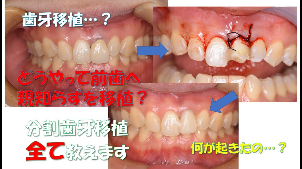 hq720.jpg?sqp=-