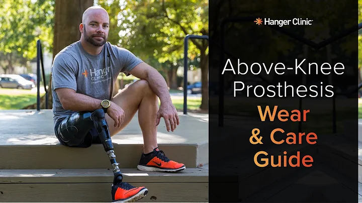 Above-Knee Prosthesis Wear & Care Guidelines