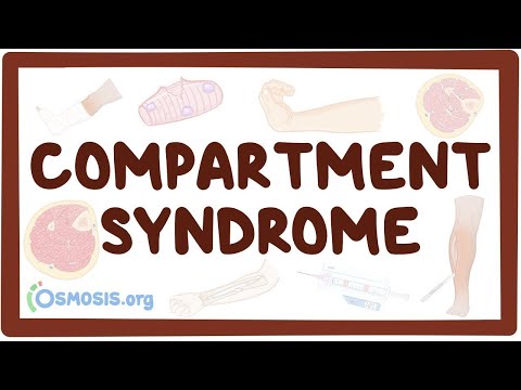 Video: Dislocation syndrome - dislocation of the brain: types, causes, diagnosis and treatment