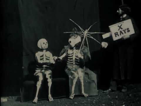 The X-Ray Fiend (1897) | When Curiosity Reveals Too Much - YouTube