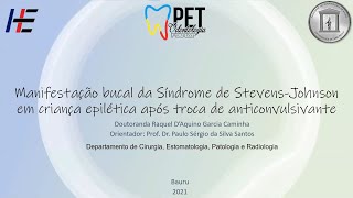 Odontologia Hospitalar: Manifestação bucal da síndrome de Stevens-Johnson - Caso clínico 2021