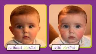 Otostick BABY Ear Corrector From 3 months up! Otostick baby can help reduce  ear prominence PERMANENTLY with continued use within a…
