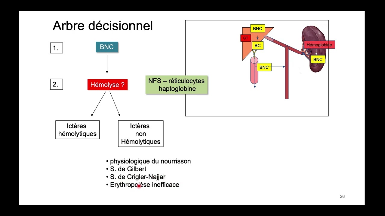 Ictère rétentionnel - DFGSM2