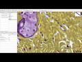Out of focus problems are causing errors in image analysis