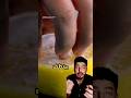 A Pharmacist Comments On A Video About Cleaning Nails With Lemon And Baking Soda Medicine Scie