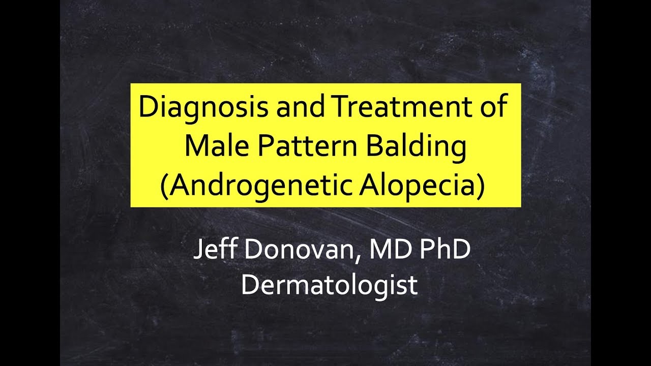 Diagnosis and Treatment of Male Pattern Balding (Male Androgenetic Alopecia)