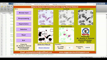 Malaria Detection Using Neural Network In Matlab Project Source Code