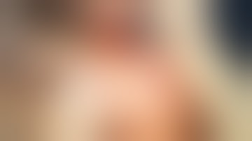 BCC face and double rotation flaps