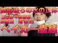 【膝の後ろに溜まる水の正体】ベイカー嚢腫(ベイカー嚢胞；SGB semimembranosus gastrocnemius bursa)《半膜様筋腓腹筋滑液包》