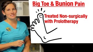 Big toe and bunion pain treated with Prolotherapy to stabilize the joint