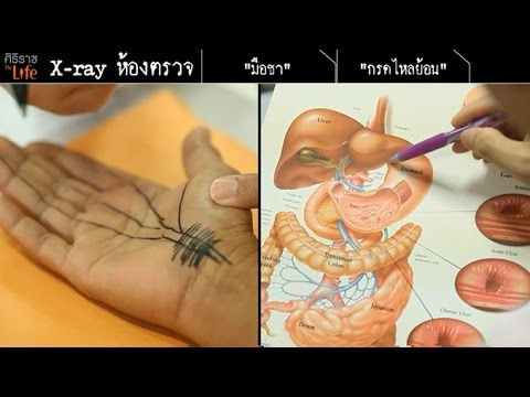 ศิริราช The Life [by Mahidol] ซีรีส์ x-ray ห้องตรวจ ตอน มือชา และ กรดไหลย้อน