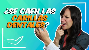 ¿Se caen fácilmente las carillas?