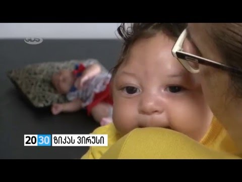 ზიკას ვირუსი/2030 (03.02.2016)