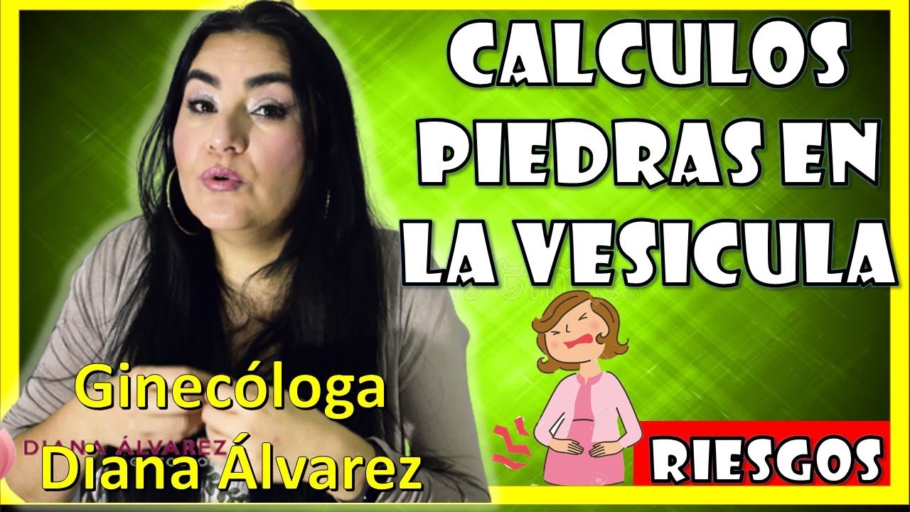CACULOS o PIEDRAS en la  VESICULA durante el EMBARAZO, por GINECOLOGA DIANA ALVAREZ
