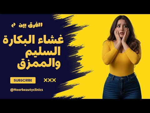 اعرفي الفرق بين غشاء البكارة السليم والممزق معلومات مهمة لازم كل بنت تعرفها