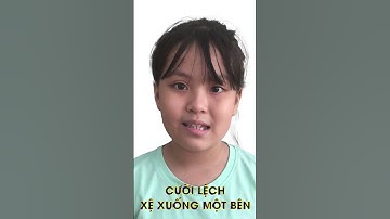 Niềng răng chữa lệch mặt liệu có thật? Tìm hiểu cùng Nha Khoa HAPPY nhé.