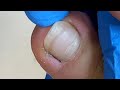 Pedicure tutorial ：You need a professional pedicure【Xue Yidao】