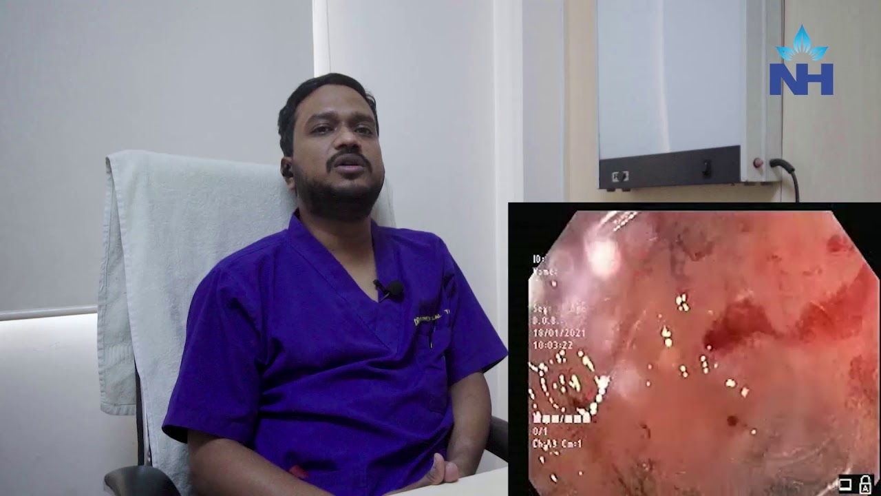 Endoscopic Clipping for Upper GI Bleeding Dr. Manik Lal Thakur