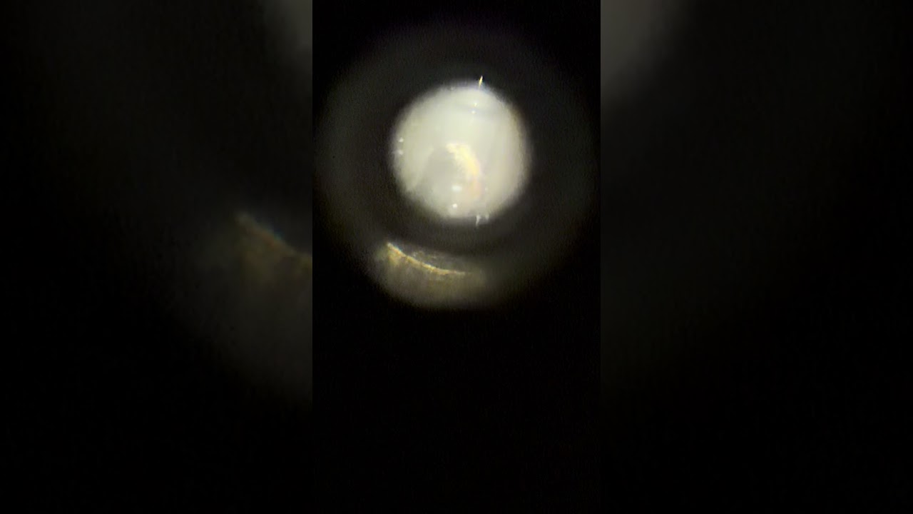 A little concerned on the issues in Atlanta. Had two EMTs enter my apartment without permission. 