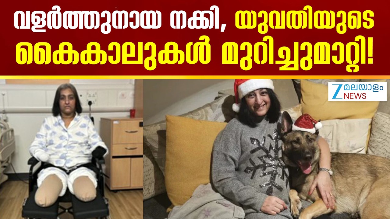 Dog Lick Infection | വളര്‍ത്തുനായ നക്കി, യുവതിയുടെ കൈകാലുകൾ മുറിച്ചുമാറ്റി!