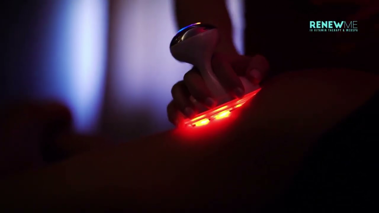 Red Light Therapy: The Game-Changer Your Skin Needs! | 