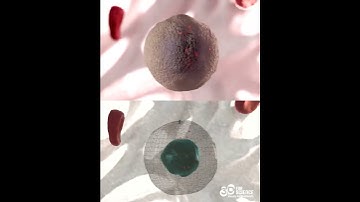 Workflow to 3D animation for Acute Myeloid Leukemia. #makingof #leukemia  #biotech  #medcomms