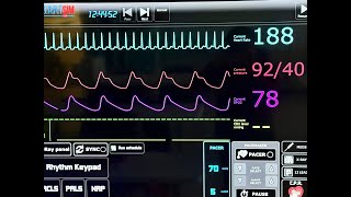ACLS Made Easier: What to Study Before Your AHA ACLS Course @DARTSim 