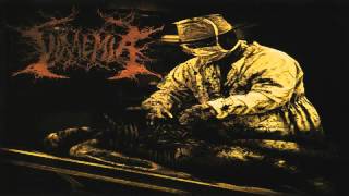 Viraemia - Cancrum Oris