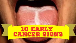 Do I Have Cancer?! When To Call A Doctor Immediately! [10 Early Warning Signs]