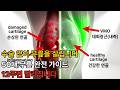 수술 없이 무릎을 살립니다— 50대 무릎 완전 가이드 (12주면 달라집니다)