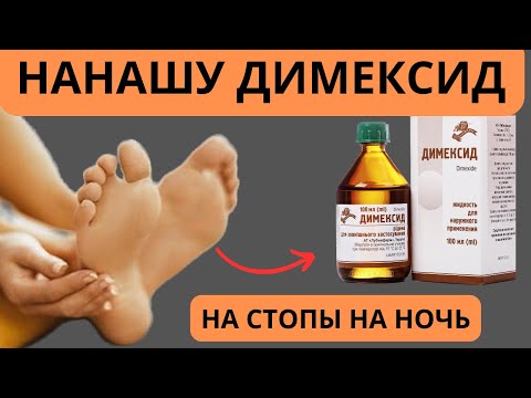 Димексид на стопы лечит даже ….. Как его наносить на стопы?..