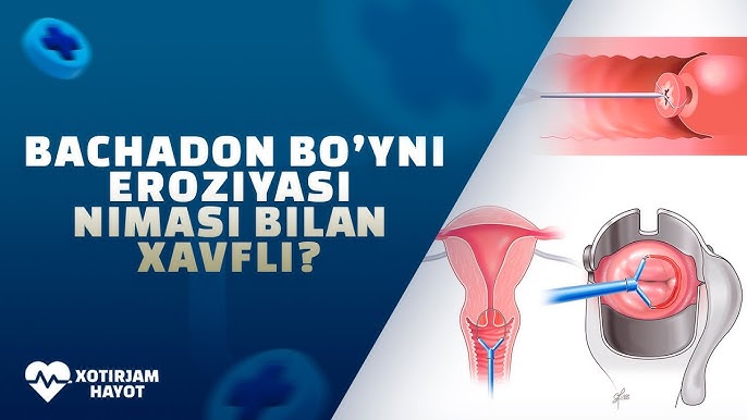 Onlayn dildo porno video