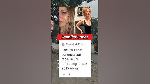 Jennifer Lopez suffers brutal facial injury rehearsing for the 2025 AMAs #shorts