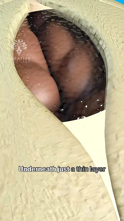 Why Does a Baby’s Soft Spot Moves 👶 - Baby’s Fontanelle #short - Creativelearning3d