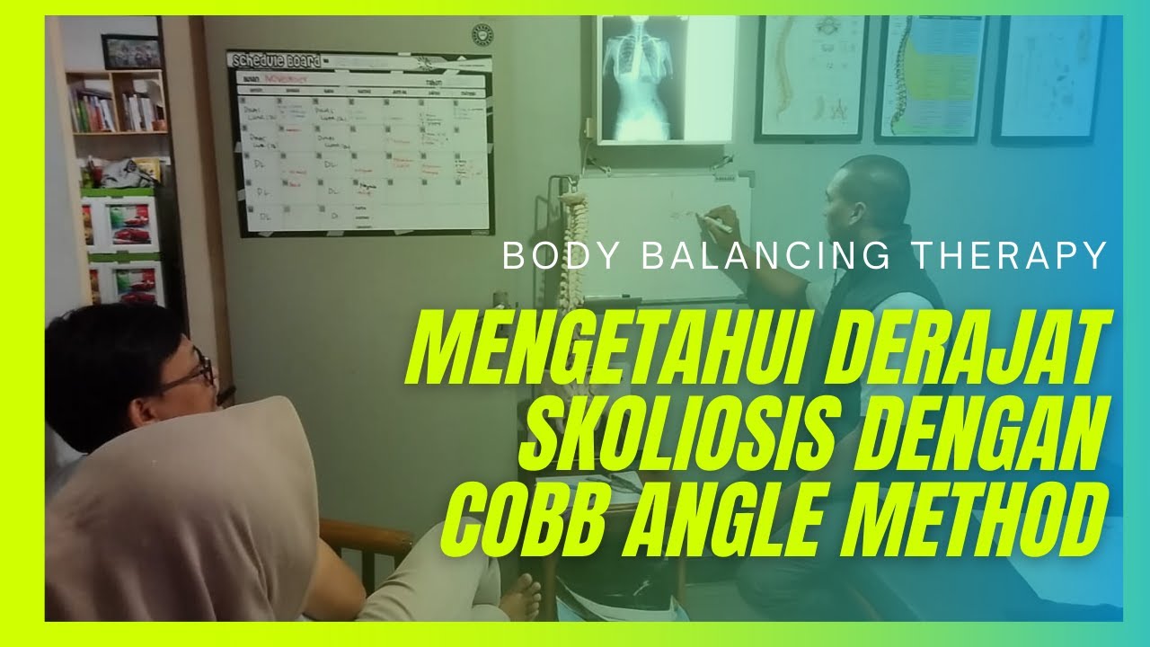 Cara Menghitung Derajat Skoliosis Dengan Cobb Angle Method. Berapa