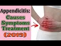 What is appendix what is appendicitis what is appendix pain causes symptoms treatment 2019